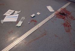 Bestialsko zabici - mord w Łodzi nie był pierwszy