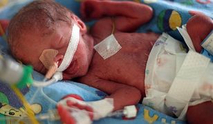 W Krakowie na świat przyszły pięcioraczki