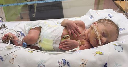 Wcześniak cudem przeżył fatalną pomyłkę pielęgniarek
