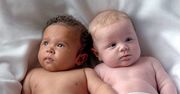 Bliźniaki zmieniają kolor skóry