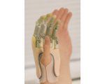 Bioniczne palce - szansa dla wielu osób