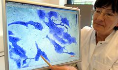 Ponad 1500 zakażonych - kolejny Polak ofiarą bakterii?