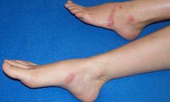 Podstępnie atakują i wstrzykują nam truciznę!