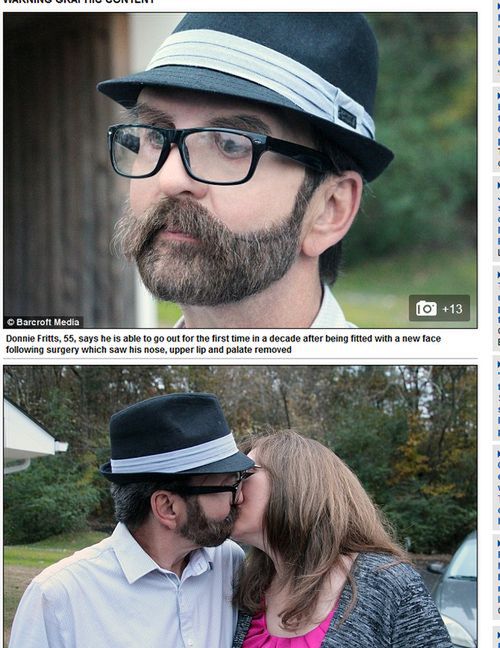 Pocałował żonę po raz pierwszy po 10 latach. Zmagał się z rakiem, przeszedł rekonstrukcję twarzy