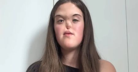 18-letnia Paulina urodziła się bez nosa: "Ludzie pokazywali na mnie PALCAMI"