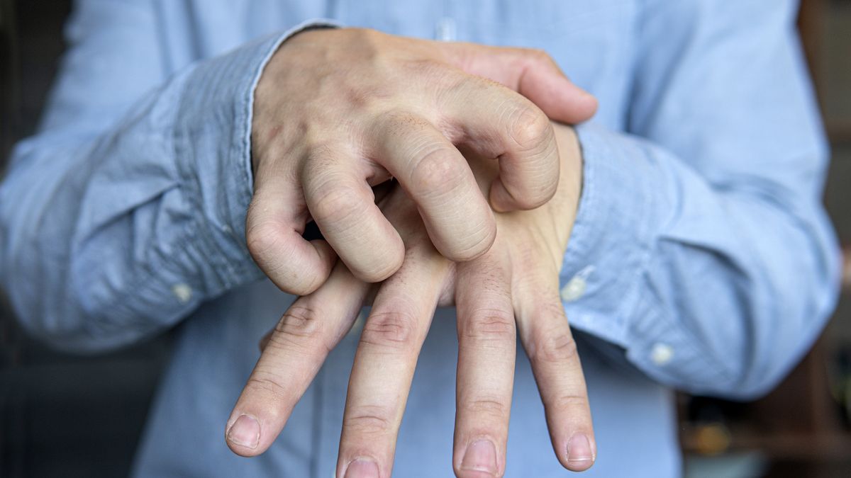 Zakaźna choroba skóry, która łatwo się rozprzestrzenia