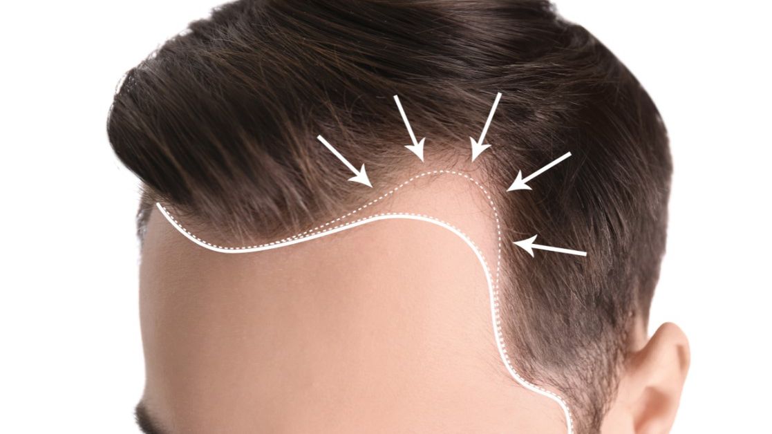 Loxon – właściwości i działanie, skład, dawkowanie, przeciwwskazania, opinie, zamienniki