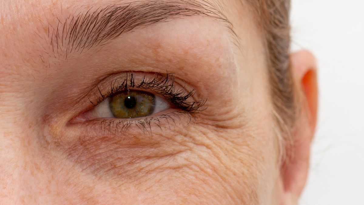 Fakty i mity na temat zmarszczek