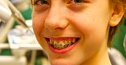 Korekta kształtu zębów