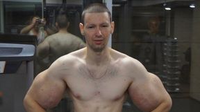 "Rosyjski Popeye" dał się namówić na operację. Gigantyczne bicepsy zaczynają znikać