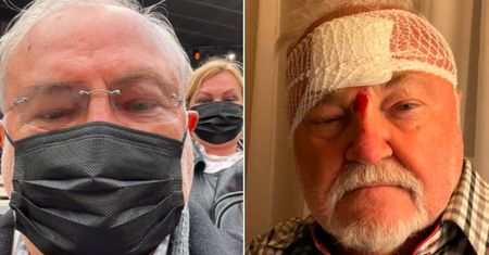 Andrzej Kosmala miał wypadek. Z koncertu dla Krawczyka trafił do szpitala