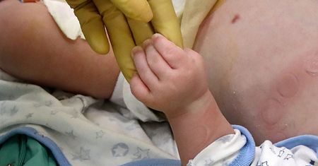 Nowy patogen atakuje małe dzieci. Lekarze pokazali niepokojące zdjęcie