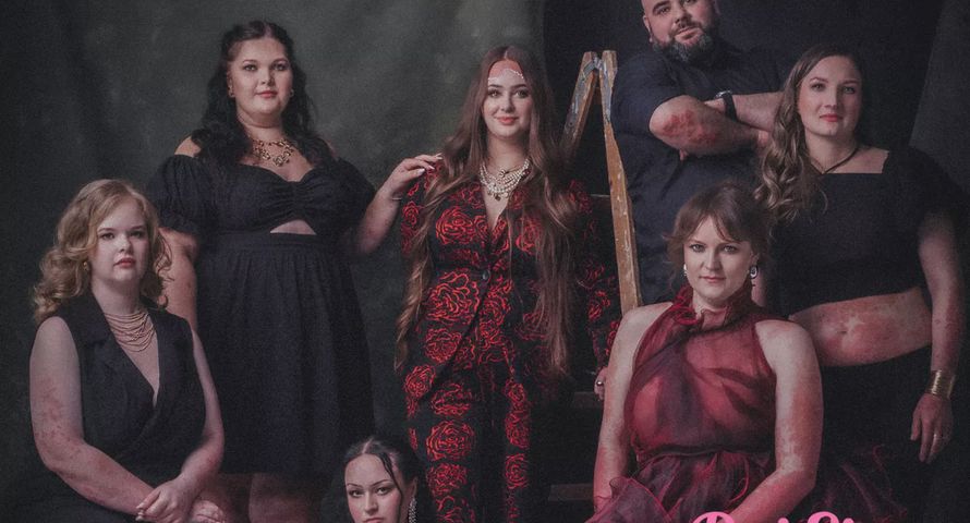 Łuszczyca bez tabu w kampanii „Daj się odkryć”