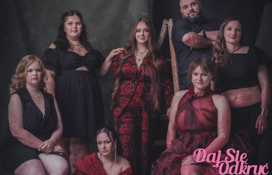 Łuszczyca bez tabu w kampanii „Daj się odkryć”