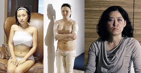 Tak operują się Koreanki, żeby wyglądać bardziej "zachodnio" (ZDJĘCIA)