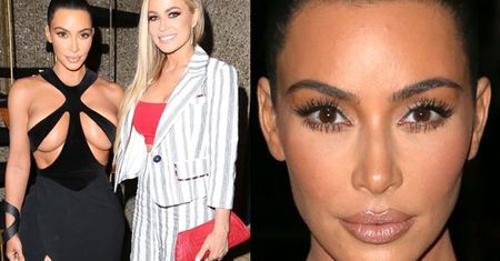 Kim Kardashian z zabandażowanym biustem pozuje u boku Carmen Electry (FOTO)