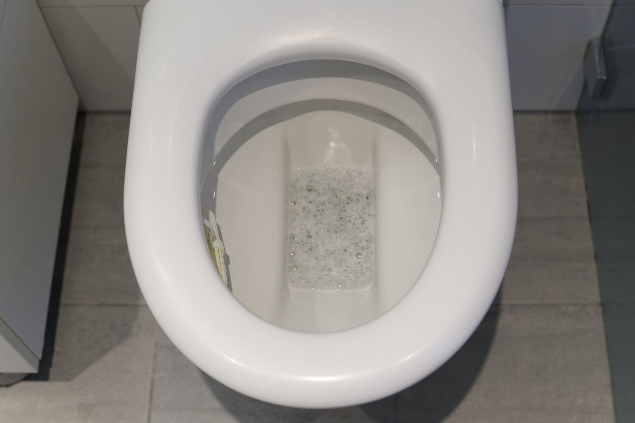 Home remedies to banish yellow toilet seat stains effortlessly