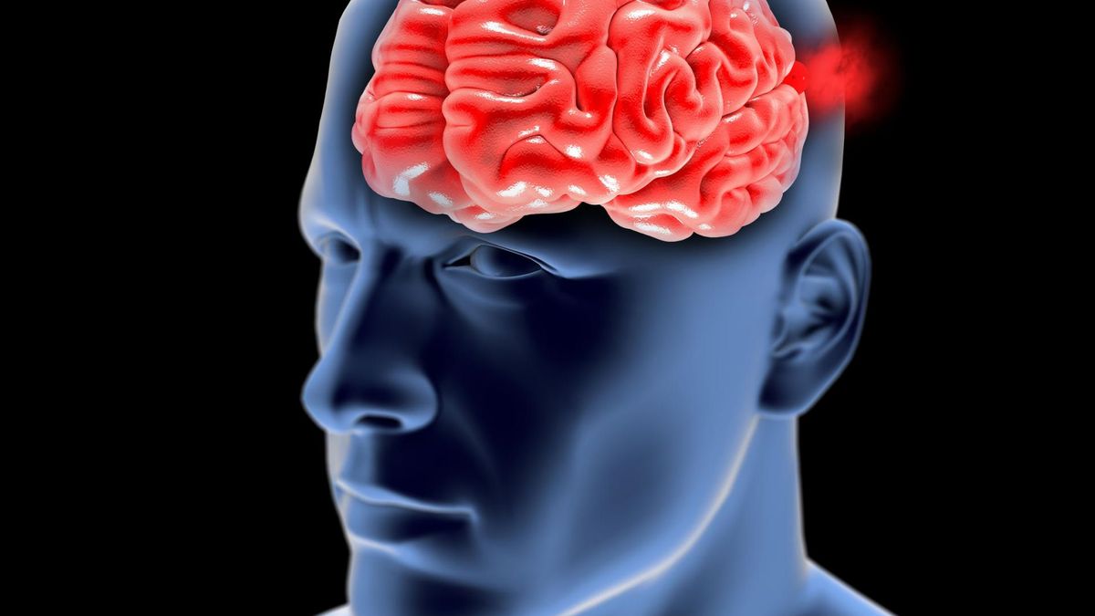 Tętniak lokalizuje się w ścianach krwionośnych i blisko osłabionej tętnicy (123rf.com)