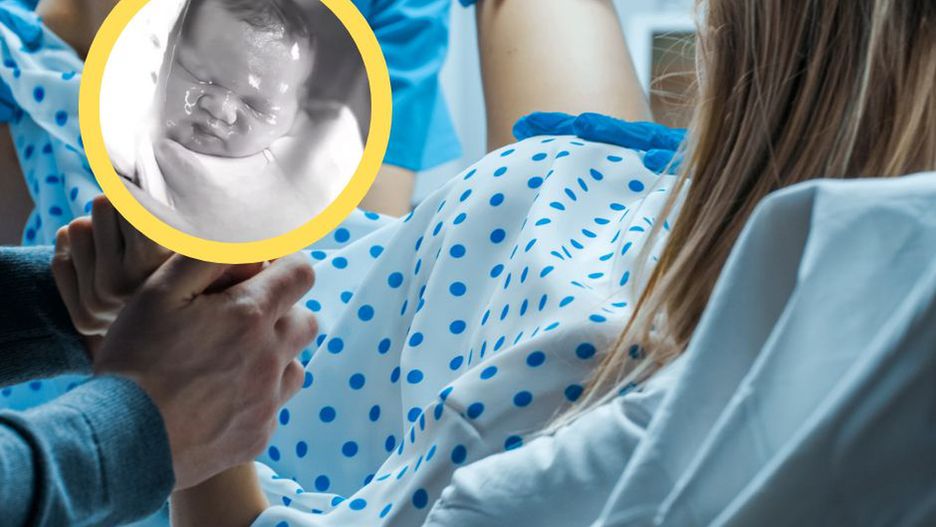 Niesamowita chwila podczas porodu. Takie chwile zdarzają się raz na 80 tys.
