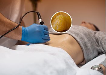 Zbija cholesterol. Może odwrócić stłuszczenie wątroby