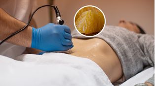 Zbija cholesterol. Może odwrócić stłuszczenie wątroby