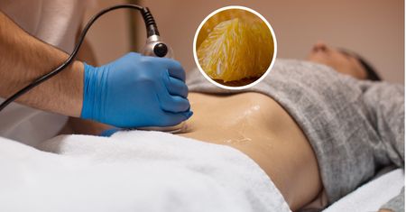 Pogromca cholesterolu.. Może odwrócić stłuszczenie wątroby
