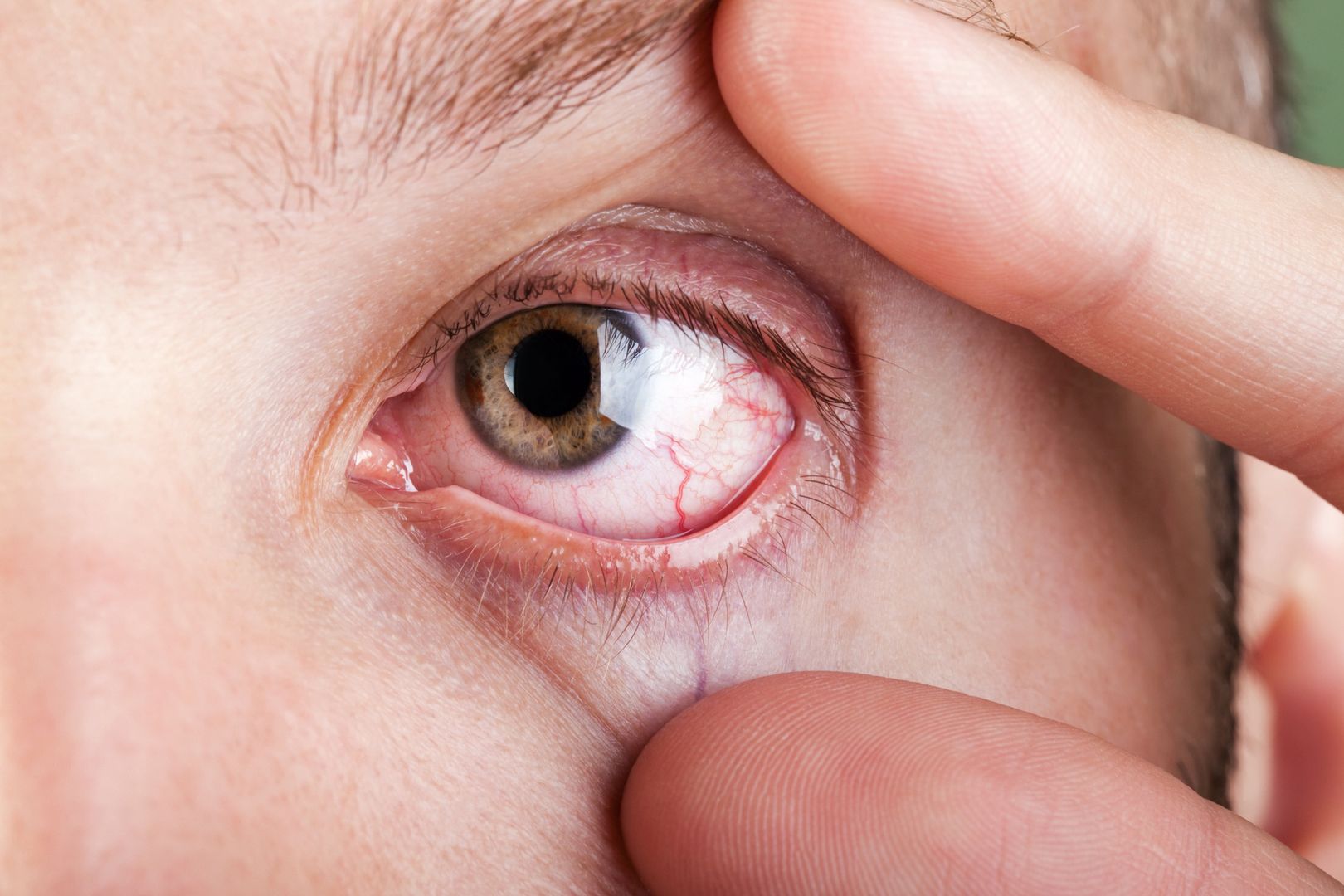 Blood capillary human eye
ia_64