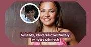 Te gwiazdy zainwestowały w nowy uśmiech. Zobaczcie, jak wyglądały wcześniej