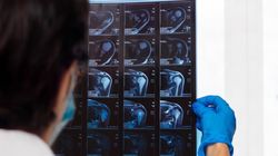 Rezonans magnetyczny barku - przebieg, wskazania i przygotowanie