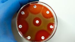 Paciorkowcowy zespół wstrząsu toksycznego - przyczyny, objawy i leczenie