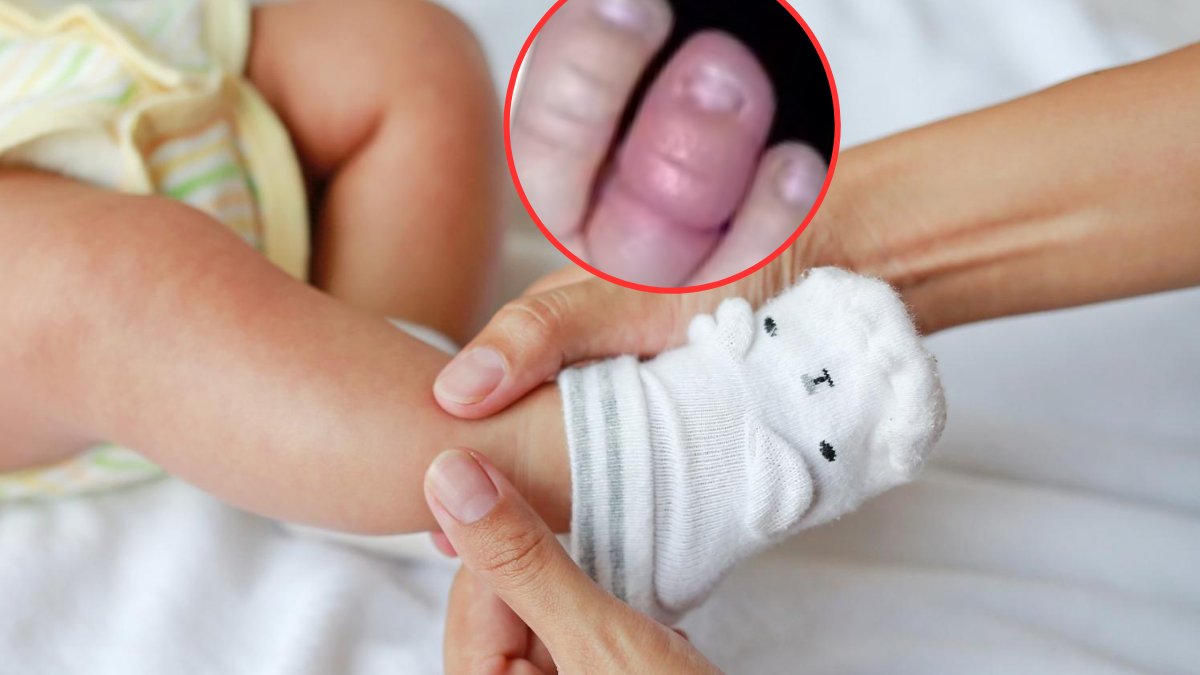 Włókna ze skarpetek mogą owinąć się wokół palca dziecka