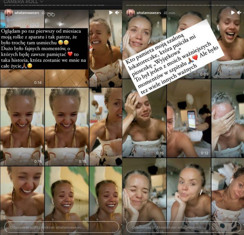 Anna Skura kontynuuje temat nieudanego zabiegu powiększania piersi