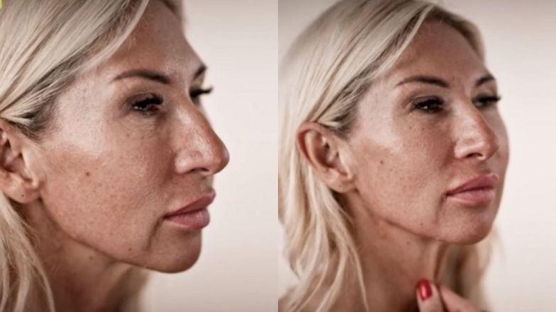 "Młodość na zamówienie". Metamorfoza Martiny zachwyciła jej przyjaciółki