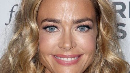 Poprawianie urody zbiera żniwo