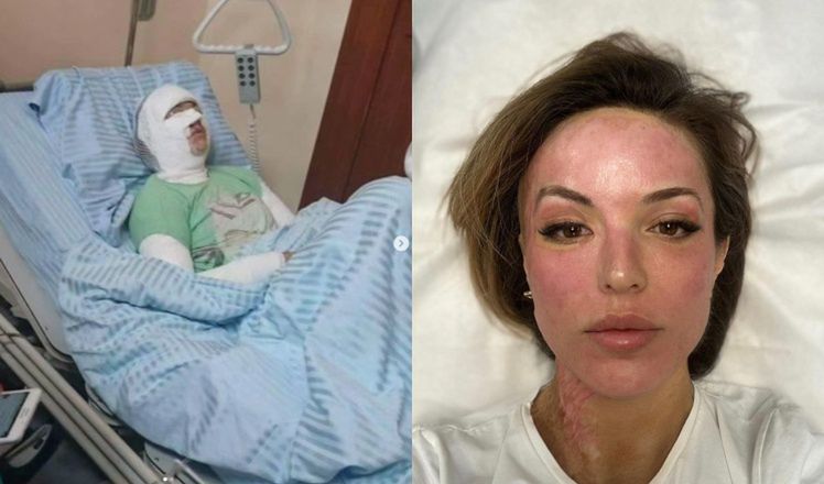 7 lat temu stalker oblał ją KWASEM. Dziś Katarzyna Dacyszyn wyznaje, jak zmieniło się jej życie (FOTO)