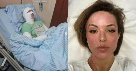 7 lat temu stalker oblał ją KWASEM. Dziś Katarzyna Dacyszyn wyznaje, jak zmieniło się jej życie (FOTO)