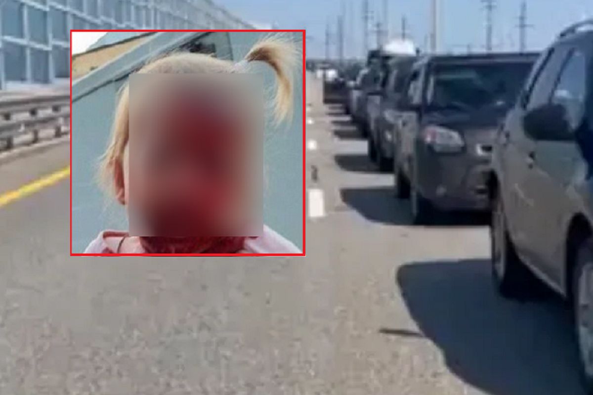 Dramatic accident in Crimea. A 3-year-old girl was taken to hospital