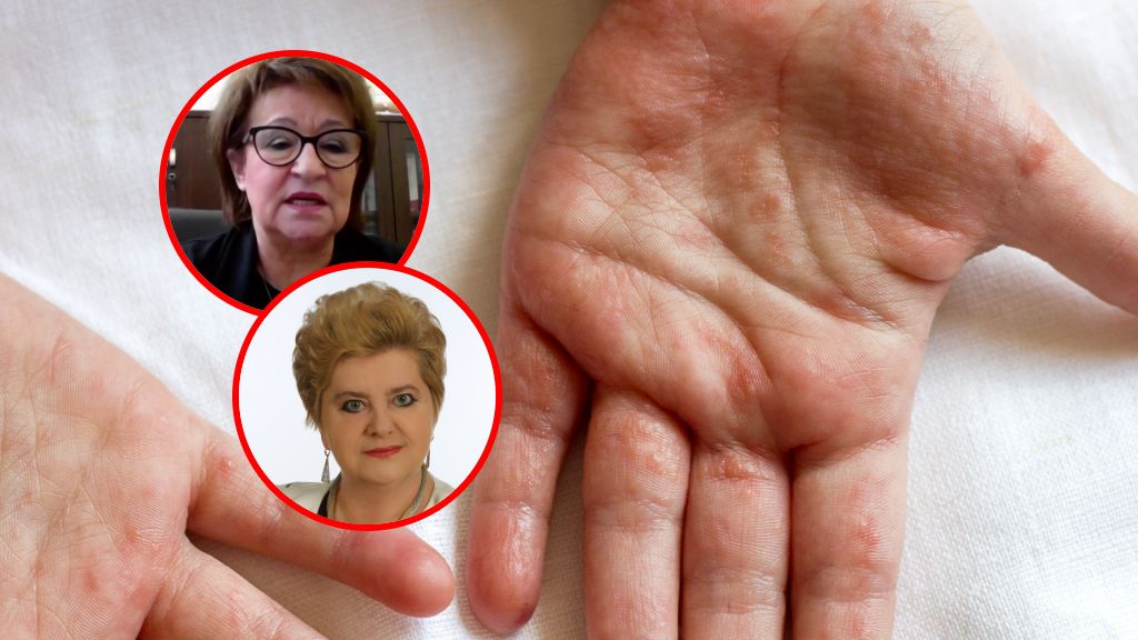 Polacy walczą z superbakteriami. Lekarka: mamy wysyp dwóch chorób