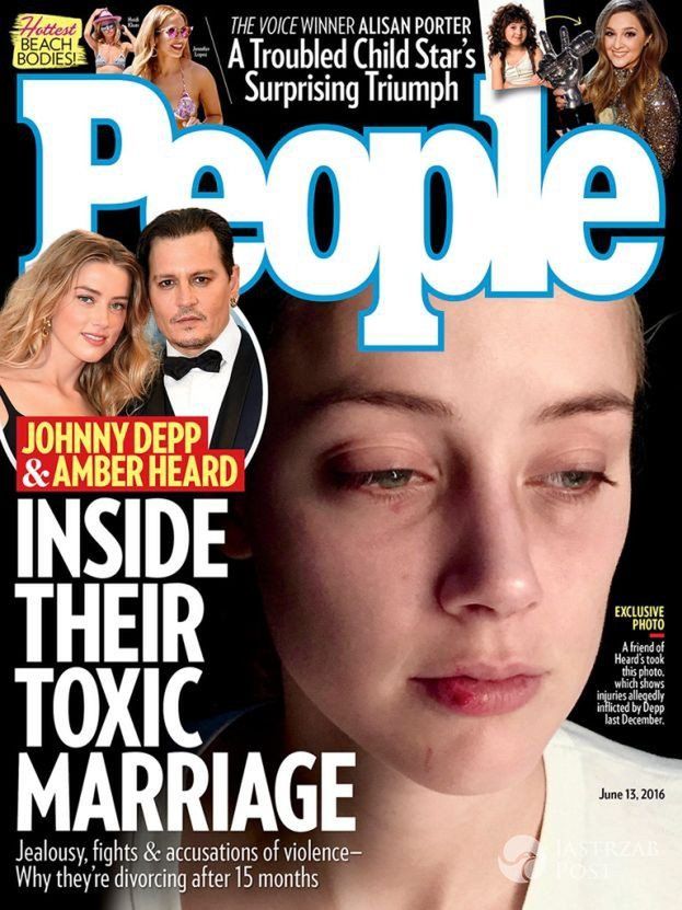 Posiniaczona Amber Heard