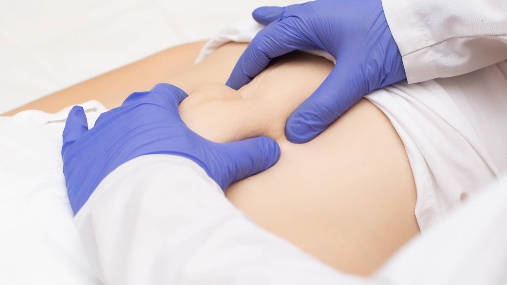 Przepuklina przeponowa to nieprawidłowość będąca skutkiem wpuklenia się trzewi jamy brzusznej do klatki piersiowej.