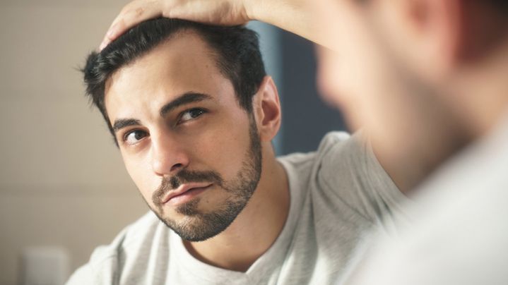 łysienie androgenowe