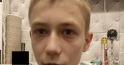 Siedlce: Zaginął 14-letni Jakub. Policja apeluje o pomoc