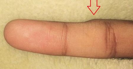 "Smartphone Pinky" – nowe schorzenie cywilizacyjne. Grozi dorosłym i dzieciom