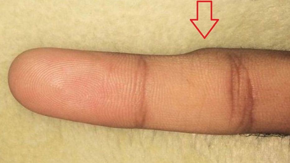 Długotrwałe korzystanie ze smartfonu może wywołać efekt Smartphone Pinky