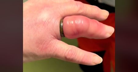 Nagranie ma 2 mln odsłon. Wideo ratownika z 30-letnim doświadczeniem