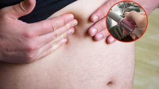 10-15 proc. pacjentów nie chudnie po lekach GLP-1. Osiągają za to inne korzyści