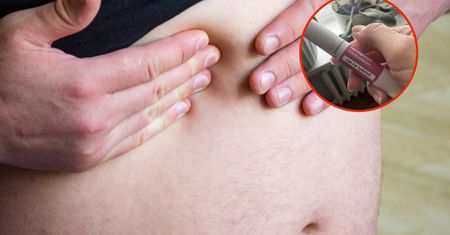 10-15 proc. pacjentów nie chudnie po lekach GLP-1. Osiągają za to inne korzyści
