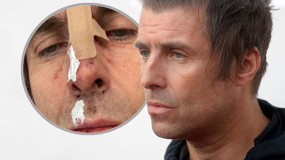 Liam Gallagher miał szczęście, że helikopter stał na ziemi.