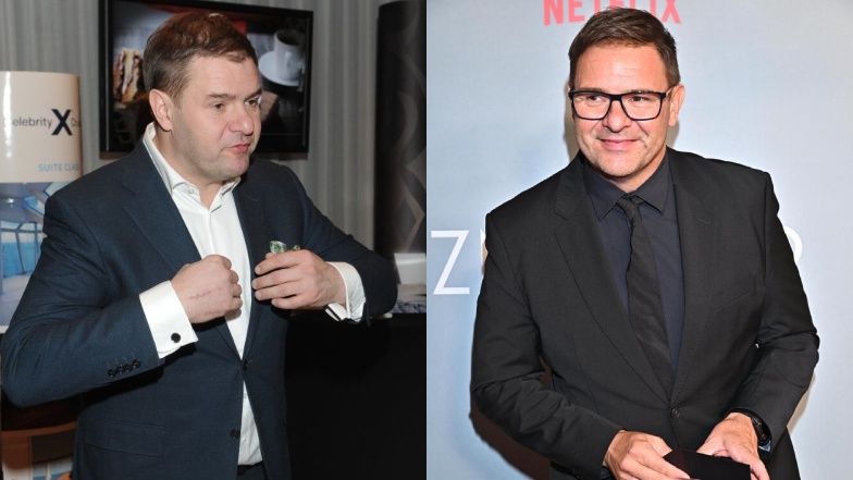 Gwiazdy, które zdecydowały się na przeszczep włosów
