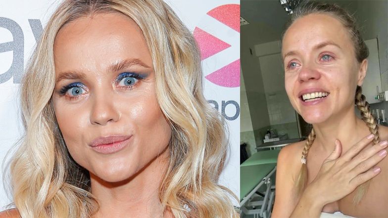 Anna Skura pokazuje efekt operacji piersi 